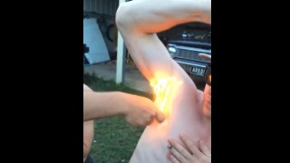Moron Purposely Has Friend Light His Armpit on Fire After Night of Drinking